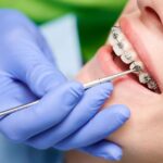 Orthodontic Services in Norman, OK