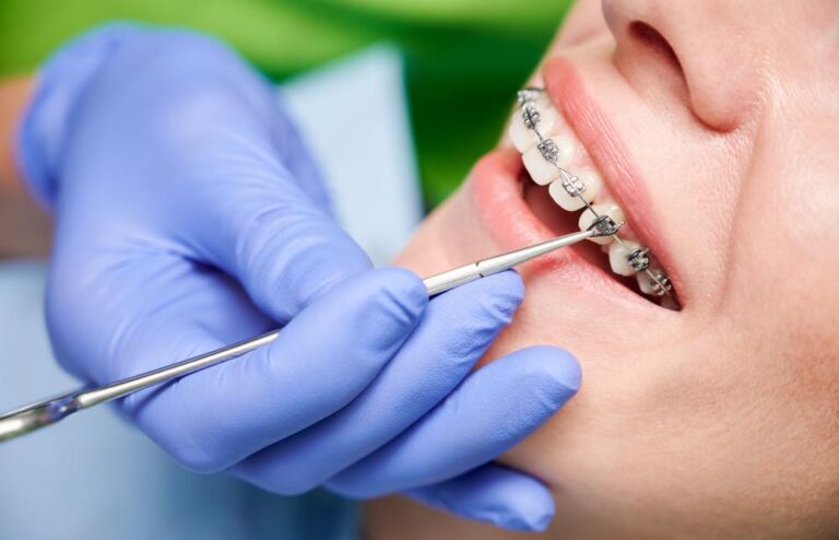 Orthodontic Services in Norman, OK